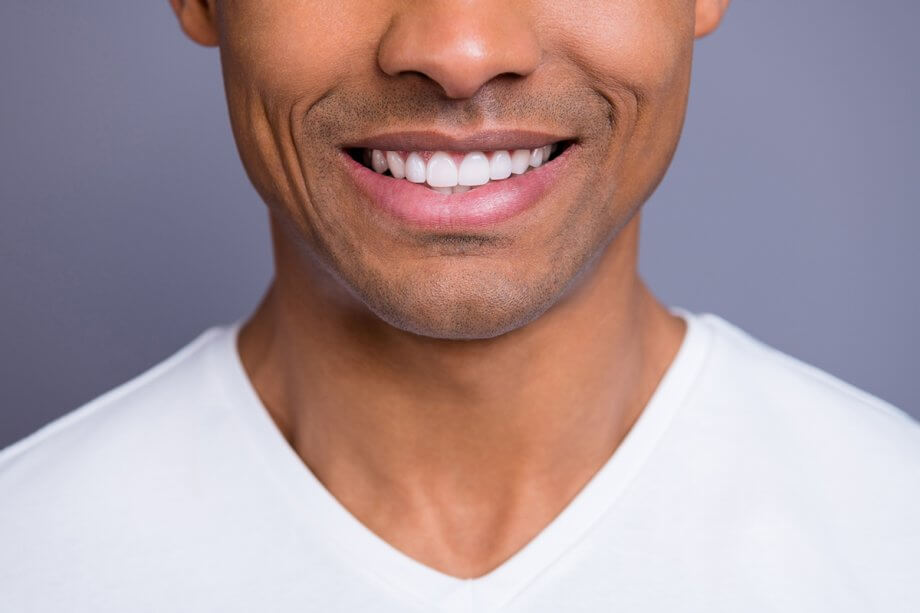 3 Options For Whitening Your Teeth