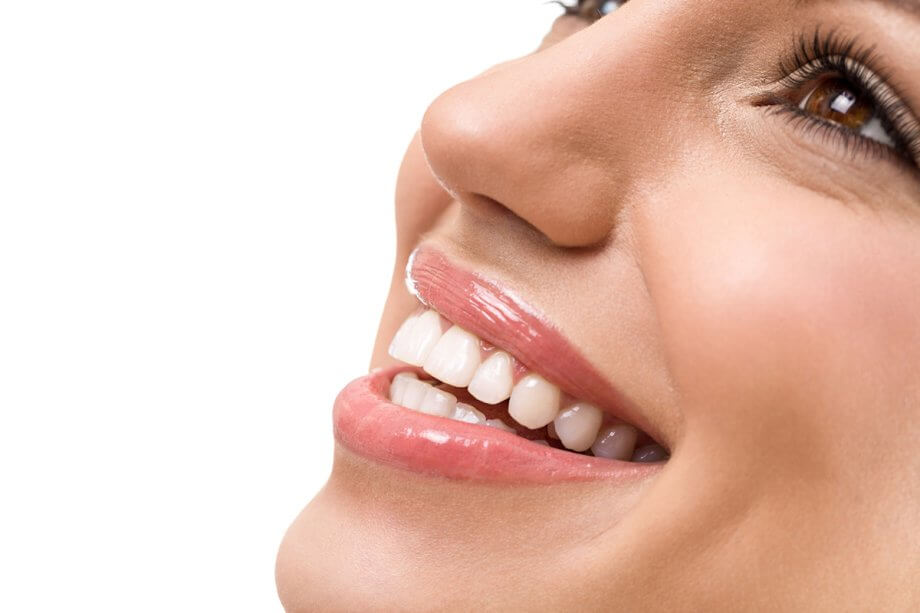How Do Veneers Work?