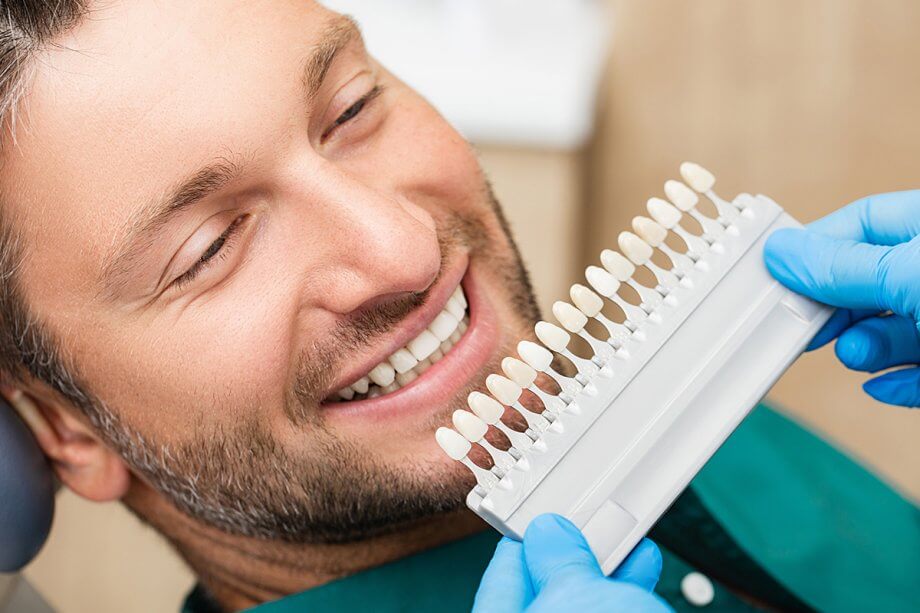 How Long Do Dental Veneers Last?