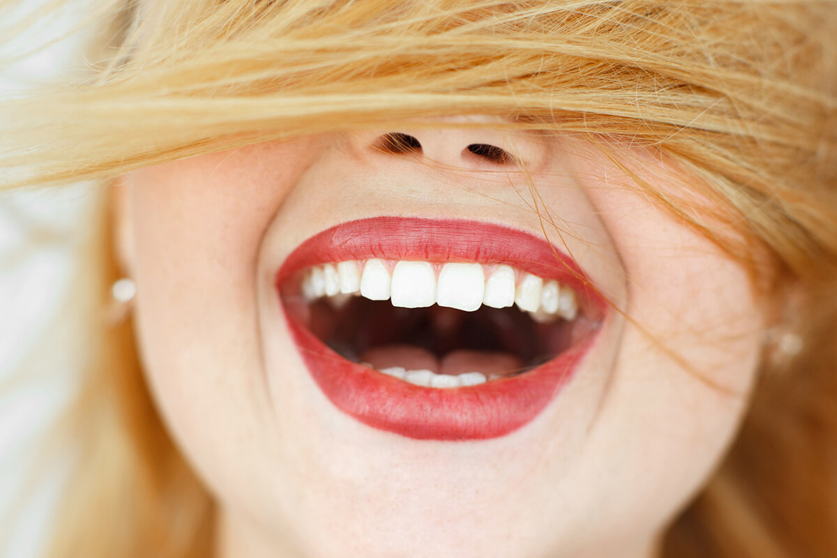 How Long Does It Take To Whiten Teeth? A&R Advanced Dental Group