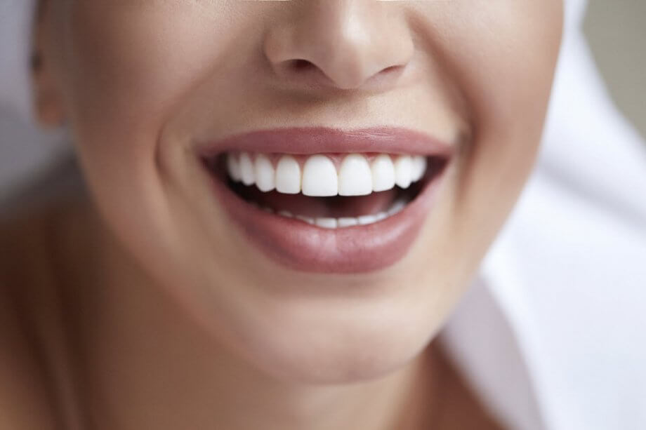 Photogenic Smile with ARA Advanced Dental